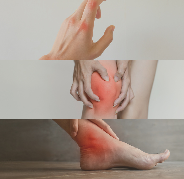 「関節の痛み」に、「再生医療」という答え